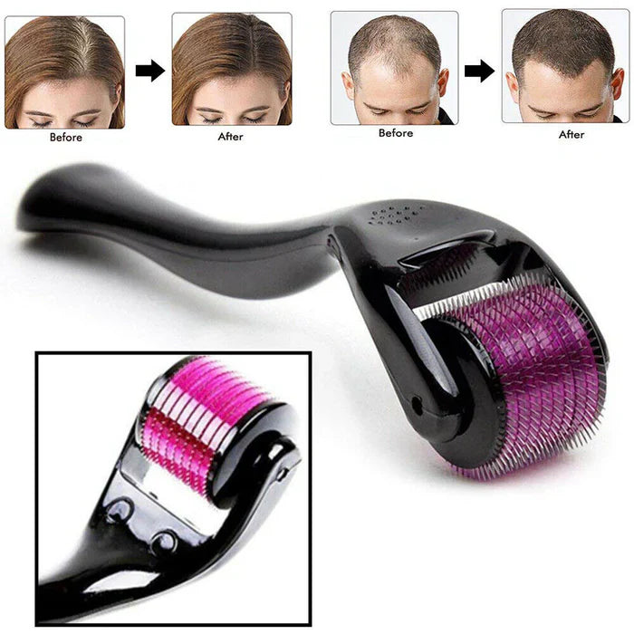 Derma Roller System 0.5mm with before and after images on a white background