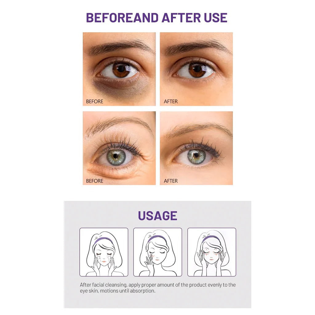 Before and after use comparison of Disaar Anti-Aging Retinol Eye Cream – 25g with usage instructions.