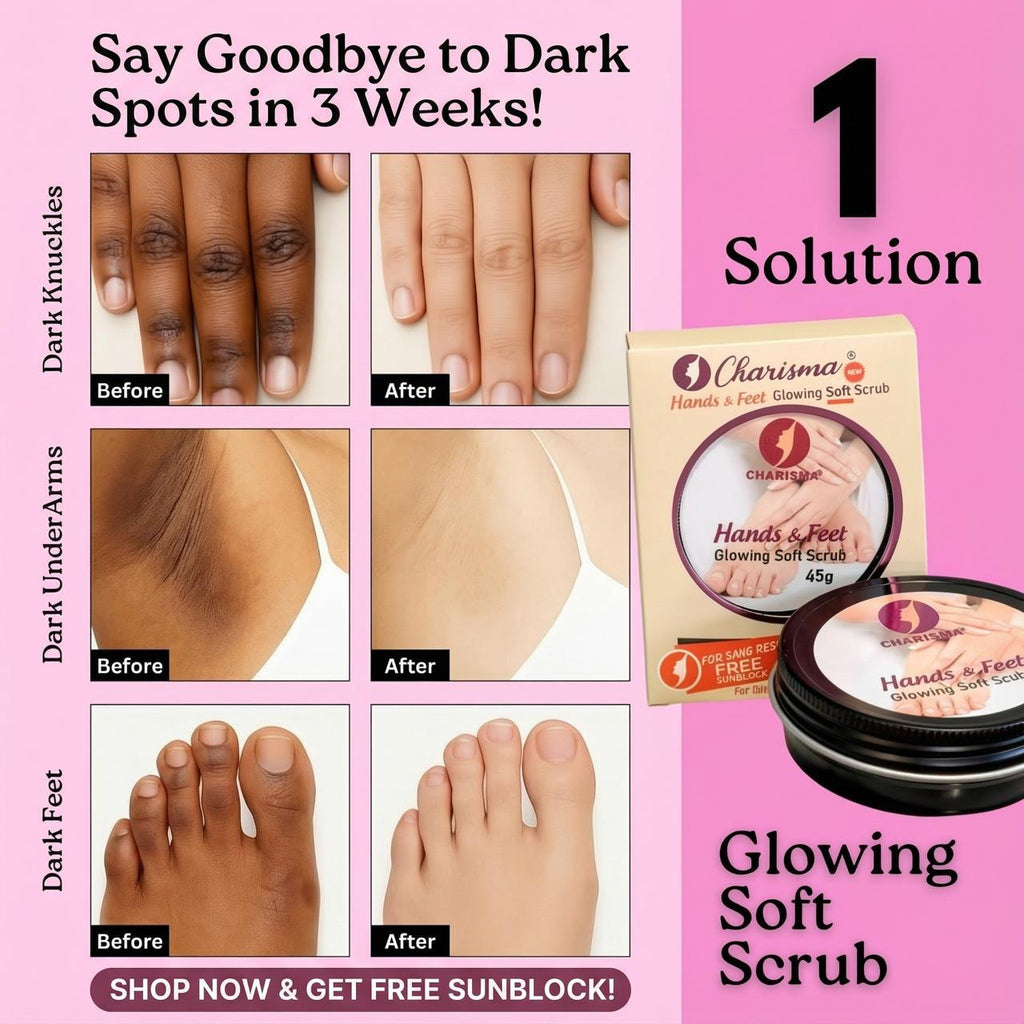Advertisement for Charisma Hands & Feet Glowing Soft Scrub with before and after images of dark spots on knuckles, under arms, and feet.
